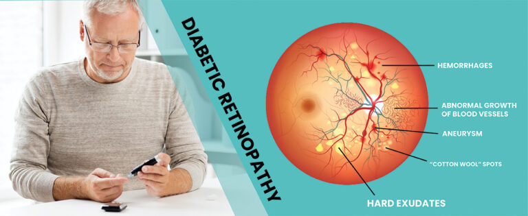 Diabetic retinopathy