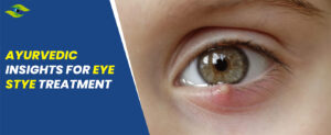 Eye Stye Treatment