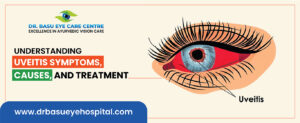 Uveitis