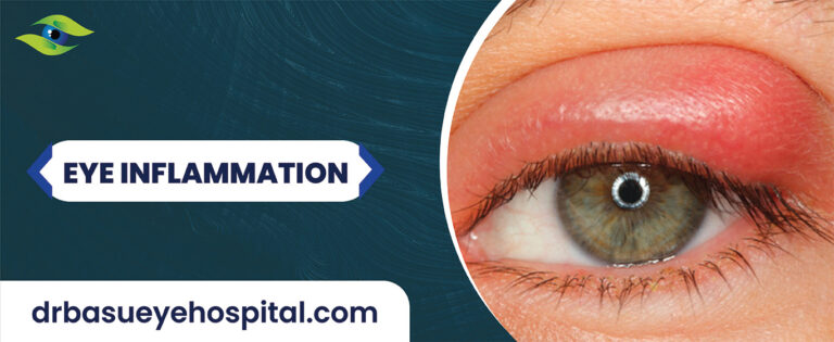 Eye Inflammation