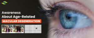 Macular Degeneration